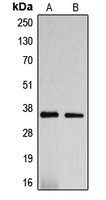 Western blot analysis of DNAJC17 expression in HepG2 (A); SP2/0 (B) whole cell lysates.
