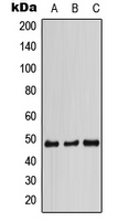 Western blot analysis of STAP2 expression in HCT116 (A); SP2/0 (B); PC12 (C) whole cell lysates.