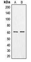 Western blot analysis of CSGALNACT1 expression in MCF7 (A); K562 (B) whole cell lysates.