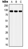 Western blot analysis of Apolipoprotein E Receptor 2 expression in MCF7 (A); NIH3T3 (B); H9C2 (C) whole cell lysates.