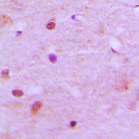 Immunohistochemical analysis of RCC2 staining in human brain formalin fixed paraffin embedded tissue section. The section was pre-treated using heat mediated antigen retrieval with sodium citrate buffer (pH 6.0). The section was then incubated with the antibody at room temperature and detected using an HRP conjugated compact polymer system. DAB was used as the chromogen. The section was then counterstained with haematoxylin and mounted with DPX.