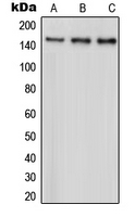 Western blot analysis of PARD3 expression in HeLa (A); A431 (B); MCF7 (C) whole cell lysates.