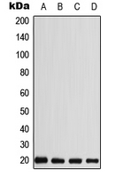 Western blot analysis of CABP5 expression in MDMB435 (A); HEK293T (B); SP2/0 (C); H9C2 (D) whole cell lysates.
