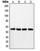 Western blot analysis of RAD18 expression in MCF7 (A); A549 (B); Jurkat (C); HCT116 (D) whole cell lysates.