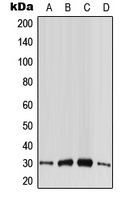 Western blot analysis of CABP4 expression in HeLa (A); HepG2 (B); SP2/0 (C); PC12 (D) whole cell lysates.