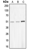 Western blot analysis of CHRNA10 expression in MDAMB453 (A); NCIH292 (B); COLO205 (C) whole cell lysates.