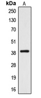 Western blot analysis of CYSLTR2 expression in A10 (A) whole cell lysates.