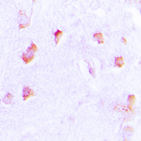 Immunohistochemical analysis of Collagen 20 alpha 1 staining in human brain formalin fixed paraffin embedded tissue section. The section was pre-treated using heat mediated antigen retrieval with sodium citrate buffer (pH 6.0). The section was then incubated with the antibody at room temperature and detected using an HRP conjugated compact polymer system. DAB was used as the chromogen. The section was then counterstained with haematoxylin and mounted with DPX.
