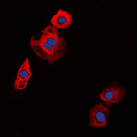 Immunofluorescent analysis of Collagen 20 alpha 1 staining in HT29 cells. Formalin-fixed cells were permeabilized with 0.1% Triton X-100 in TBS for 5-10 minutes and blocked with 3% BSA-PBS for 30 minutes at room temperature. Cells were probed with the primary antibody in 3% BSA-PBS and incubated overnight at 4 C in a humidified chamber. Cells were washed with PBST and incubated with a DyLight 594-conjugated secondary antibody (red) in PBS at room temperature in the dark. DAPI was used to stain the cell nuclei (blue).
