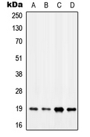 Western blot analysis of MYL7 expression in MCF7 (A); K562 (B); SP2/0 (C); H9C2 (D) whole cell lysates.