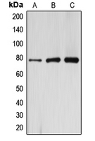 Western blot analysis of ARHGAP22 expression in HeLa (A); mouse kidney (B); rat kidney (C) whole cell lysates.