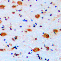 Immunohistochemical analysis of ARHGAP22 staining in human brain formalin fixed paraffin embedded tissue section. The section was pre-treated using heat mediated antigen retrieval with sodium citrate buffer (pH 6.0). The section was then incubated with the antibody at room temperature and detected using an HRP conjugated compact polymer system. DAB was used as the chromogen. The section was then counterstained with haematoxylin and mounted with DPX.