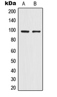 Western blot analysis of TRPV4 expression in HepG2 (A); HeLa (B) whole cell lysates.