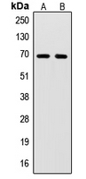 Western blot analysis of SENP2 expression in HL60 (A); Jurkat (B) whole cell lysates.