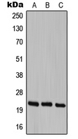 Western blot analysis of Cerebellin 1 expression in HEK293T (A); SP2/0 (B); PC12 (C) whole cell lysates.
