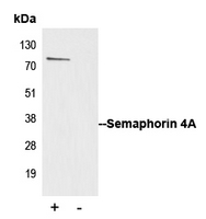 Immunoprecipitation of Semaphorin 4A from 0.5mg Jurkat whole cell extract lysate using 5ug of Anti-Semaphorin 4A Antibody and 50ul of protein G magnetic beads (+). No antibody was added to the control (-). The antibody was incubated under agitation with Protein G beads for 10min Jurkat whole cell extract lysate diluted in RIPA buffer was added to each sample and incubated for a further 10min under agitation. Proteins were eluted by addition of 40ul SDS loading buffer and incubated for 10min at 70 C; 10ul of each sample was separated on a SDS PAGE gel transferred to a nitrocellulose membrane blocked with 5% BSA and probed with Anti-Semaphorin 4A Antibody.