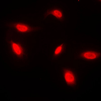 Immunofluorescent analysis of ANAPC1 staining in HeLa cells. Formalin-fixed cells were permeabilized with 0.1% Triton X-100 in TBS for 5-10 minutes and blocked with 3% BSA-PBS for 30 minutes at room temperature. Cells were probed with the primary antibody in 3% BSA-PBS and incubated overnight at 4 C in a humidified chamber. Cells were washed with PBST and incubated with a DyLight 594-conjugated secondary antibody (red) in PBS at room temperature in the dark. DAPI was used to stain the cell nuclei (blue).