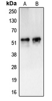 Western blot analysis of CAMKV expression in HL60 (A); HuvEc (B) whole cell lysates.