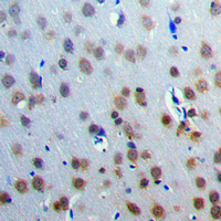 Immunohistochemical analysis of CAMKV staining in human brain formalin fixed paraffin embedded tissue section. The section was pre-treated using heat mediated antigen retrieval with sodium citrate buffer (pH 6.0). The section was then incubated with the antibody at room temperature and detected using an HRP conjugated compact polymer system. DAB was used as the chromogen. The section was then counterstained with haematoxylin and mounted with DPX.