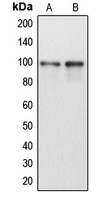 Western blot analysis of DDX54 expression in HeLa (A); Jurkat (B) whole cell lysates.