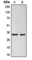 Western blot analysis of ELOVL6 expression in Raji (A); HuvEc (B) whole cell lysates.