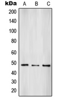 Western blot analysis of SUV39H2 expression in HepG2 (A); A431 (B); HL60 (C) whole cell lysates.