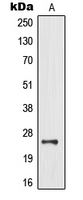 Western blot analysis of MOB3B expression in human brain (A) whole cell lysates.