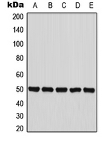 Western blot analysis of PANK2 expression in HepG2 (A); MCF7 (B); HT29 (C); mouse liver (D); PC12 (E) whole cell lysates.