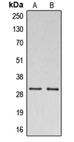 Western blot analysis of CSP expression in A549 (A); K562 (B) whole cell lysates.