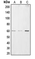 Western blot analysis of CSRNP2 expression in HEK293T (A); HepG2 (B); HuvEC (C) whole cell lysates.