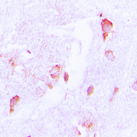 Immunohistochemical analysis of CSRNP2 staining in human brain formalin fixed paraffin embedded tissue section. The section was pre-treated using heat mediated antigen retrieval with sodium citrate buffer (pH 6.0). The section was then incubated with the antibody at room temperature and detected using an HRP conjugated compact polymer system. DAB was used as the chromogen. The section was then counterstained with haematoxylin and mounted with DPX.