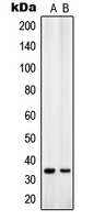 Western blot analysis of ANT4 expression in K562 (A); U251MG (B) whole cell lysates.
