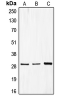 Western blot analysis of CDCA3 expression in MCF7 (A); Caco2 (B); HepG2 (C) whole cell lysates.