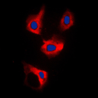 Immunofluorescent analysis of CDCA3 staining in MCF7 cells. Formalin-fixed cells were permeabilized with 0.1% Triton X-100 in TBS for 5-10 minutes and blocked with 3% BSA-PBS for 30 minutes at room temperature. Cells were probed with the primary antibody in 3% BSA-PBS and incubated overnight at 4 C in a humidified chamber. Cells were washed with PBST and incubated with a DyLight 594-conjugated secondary antibody (red) in PBS at room temperature in the dark. DAPI was used to stain the cell nuclei (blue).