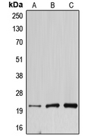 Western blot analysis of DNAL1 expression in HEK293T (A); mouse testis (B); rat kidney (C) whole cell lysates.