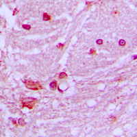 Immunohistochemical analysis of DNAL1 staining in human brain formalin fixed paraffin embedded tissue section. The section was pre-treated using heat mediated antigen retrieval with sodium citrate buffer (pH 6.0). The section was then incubated with the antibody at room temperature and detected using an HRP conjugated compact polymer system. DAB was used as the chromogen. The section was then counterstained with haematoxylin and mounted with DPX.