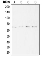 Western blot analysis of SYT16 expression in A431 (A); HeLa (B); A2058 (C); Jurkat (D) whole cell lysates.