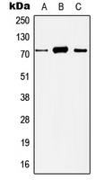 Western blot analysis of Histone Deacetylase 10 expression in HeLa (A); Jurkat (B); mouse liver (C); rat liver (D) whole cell lysates.