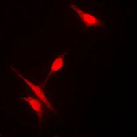 Immunofluorescent analysis of Histone Deacetylase 10 staining in Jurkat cells. Formalin-fixed cells were permeabilized with 0.1% Triton X-100 in TBS for 5-10 minutes and blocked with 3% BSA-PBS for 30 minutes at room temperature. Cells were probed with the primary antibody in 3% BSA-PBS and incubated overnight at 4 C in a humidified chamber. Cells were washed with PBST and incubated with a DyLight 594-conjugated secondary antibody (red) in PBS at room temperature in the dark. DAPI was used to stain the cell nuclei (blue).
