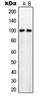 Western blot analysis of NaBC1 expression in MCF7 (A); RAW264.7 (B) whole cell lysates.