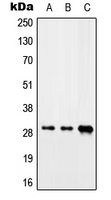 Western blot analysis of CIP29 expression in Jurkat (A); mouse heart (B); rat liver (C) whole cell lysates.