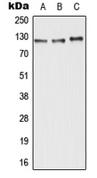 Western blot analysis of ABCC11 expression in HepG2 (A); Raw264.7 (B); H9C2 (C) whole cell lysates.