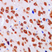 Immunohistochemical analysis of DCLK3 staining in human brain formalin fixed paraffin embedded tissue section. The section was pre-treated using heat mediated antigen retrieval with sodium citrate buffer (pH 6.0). The section was then incubated with the antibody at room temperature and detected using an HRP conjugated compact polymer system. DAB was used as the chromogen. The section was then counterstained with haematoxylin and mounted with DPX.