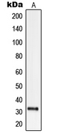 Western blot analysis of ODC expression in EFO21 (A) whole cell lysates.