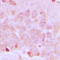 Immunohistochemical analysis of ODC staining in human brain formalin fixed paraffin embedded tissue section. The section was pre-treated using heat mediated antigen retrieval with sodium citrate buffer (pH 6.0). The section was then incubated with the antibody at room temperature and detected using an HRP conjugated compact polymer system. DAB was used as the chromogen. The section was then counterstained with haematoxylin and mounted with DPX.