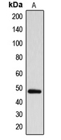Western blot analysis of ARRDC1 expression in MDAMB231 (A) whole cell lysates.