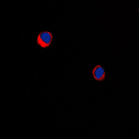 Immunofluorescent analysis of ARRDC1 staining in MDAMB231 cells. Formalin-fixed cells were permeabilized with 0.1% Triton X-100 in TBS for 5-10 minutes and blocked with 3% BSA-PBS for 30 minutes at room temperature. Cells were probed with the primary antibody in 3% BSA-PBS and incubated overnight at 4 C in a humidified chamber. Cells were washed with PBST and incubated with a DyLight 594-conjugated secondary antibody (red) in PBS at room temperature in the dark. DAPI was used to stain the cell nuclei (blue).