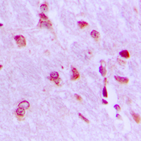 Immunohistochemical analysis of ARHGAP18 staining in human brain formalin fixed paraffin embedded tissue section. The section was pre-treated using heat mediated antigen retrieval with sodium citrate buffer (pH 6.0). The section was then incubated with the antibody at room temperature and detected using an HRP conjugated compact polymer system. DAB was used as the chromogen. The section was then counterstained with haematoxylin and mounted with DPX.