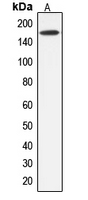 Western blot analysis of ABCC12 expression in HepG2 (A) whole cell lysates.
