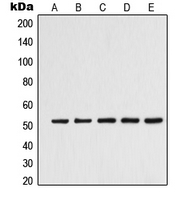 Western blot analysis of Alpha-tubulin 3C/D/E expression in K562 (A); Jurkat (B); HeLa (C); HepG2 (D); NIH3T3 (E) whole cell lysates.